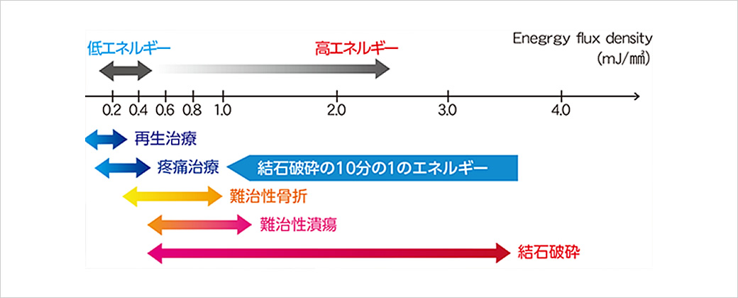 体外衝撃波治療とは